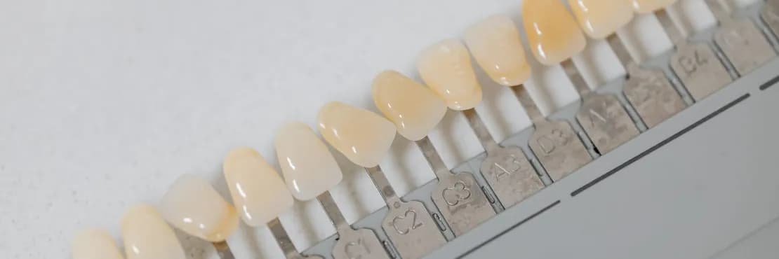 Cuidados para el éxito de blanqueamiento dental ambulatorio