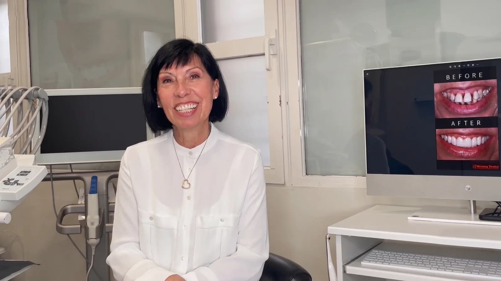 Paciente de Mesena Dental sonriendo junto a su antes y después
