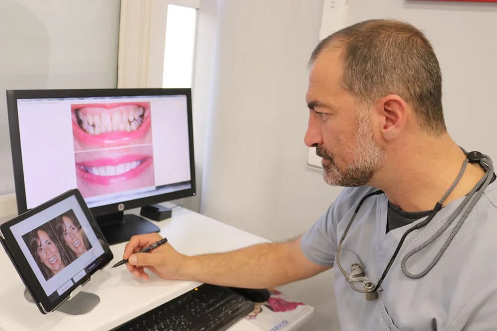 Diseño digital de sonrisa en pantalla