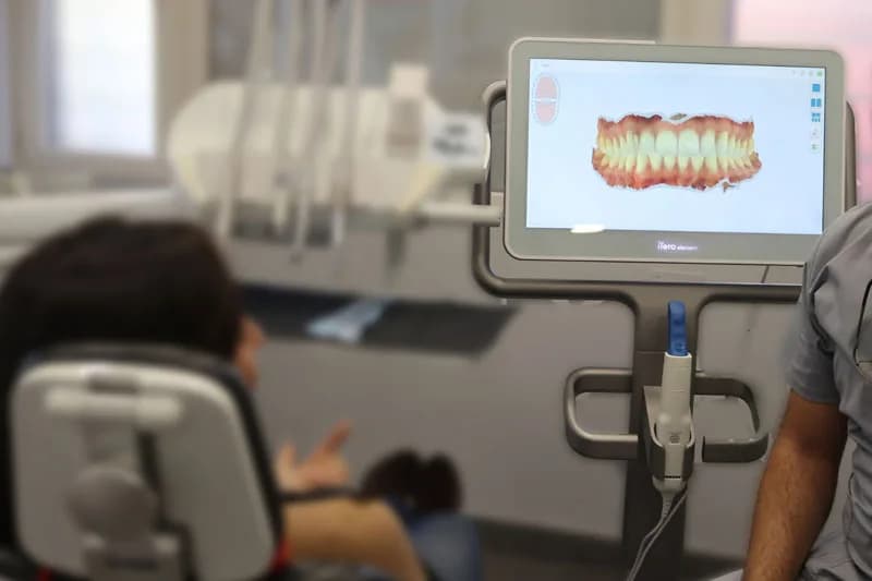 Registro con escáner intraoral para la prótesis definitiva